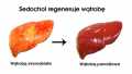 Elita-Nowochol-+-biotyna-500ml-regeneracja-watroby-i-nerek-dzialanie.jpg